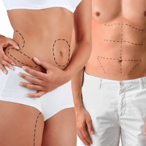 Vaser Liposuction