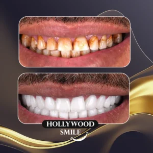 أفضل عيادة تجميل الأسنان